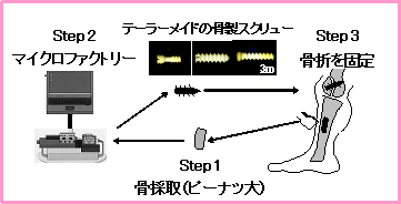 hone-system.gif hone-system.gif